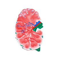 Modelo de Nodo Linfático