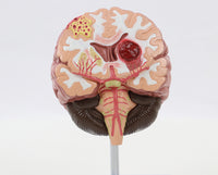 Modelo Cerebral Senil con patología