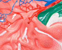 Modelo de Nodo Linfático