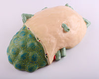 Modelo de agrandamiento de nódulos linfáticos humanos