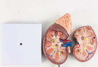 Modelo de glándula suprarrenal, sistema urinario, riñón humano, modelo anatómico