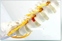 Modelo de vértebra lumbar,(nervio ciático)