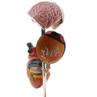 Kit modelo de patología hipertensión