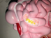 Modelo anatómico colorectal