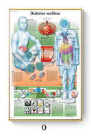 Póster de patologías humanas