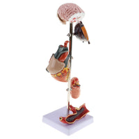 Kit modelo de patología hipertensión