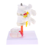 Vértebra Lumbar humana de 2 discos