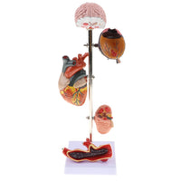 Kit modelo de patología hipertensión