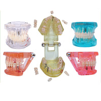 Modelo de implantes dentales