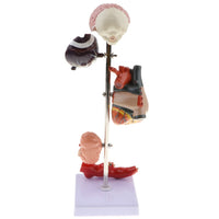 Kit modelo de patología hipertensión