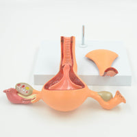 Modelo Anatomic Utero femenino (Saludable)
