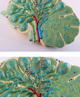 Modelo de agrandamiento de nódulos linfáticos humanos