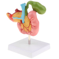 Modelo patologias de páncreas humano duodeno vesícula