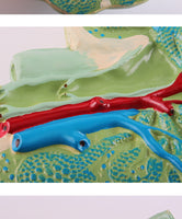 Modelo de agrandamiento de nódulos linfáticos humanos