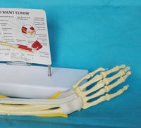 Modelo de función de ligamento articular