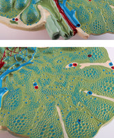 Modelo de agrandamiento de nódulos linfáticos humanos