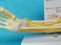 Modelo de función de ligamento articular