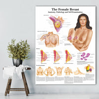 Póster anatomía / patologías de pecho (mamas )