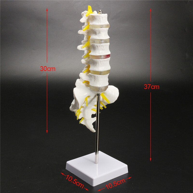 LXT PANDA Modelo de demostración de la Columna Lumbar Humana con Hernia  DIS, Modelo anatómico Vértebras lumbares Sacro y cóccix para Ciencias  Estudio en el Aula Enseñanza de exhibición. : : Industria