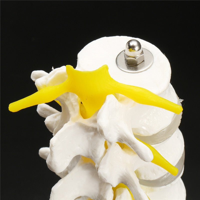 LXT PANDA Modelo de demostración de la Columna Lumbar Humana con Hernia  DIS, Modelo anatómico Vértebras lumbares Sacro y cóccix para Ciencias  Estudio en el Aula Enseñanza de exhibición. : : Industria