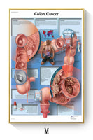 Póster de patologías humanas