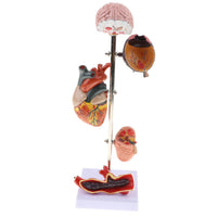 Kit modelo de patología hipertensión