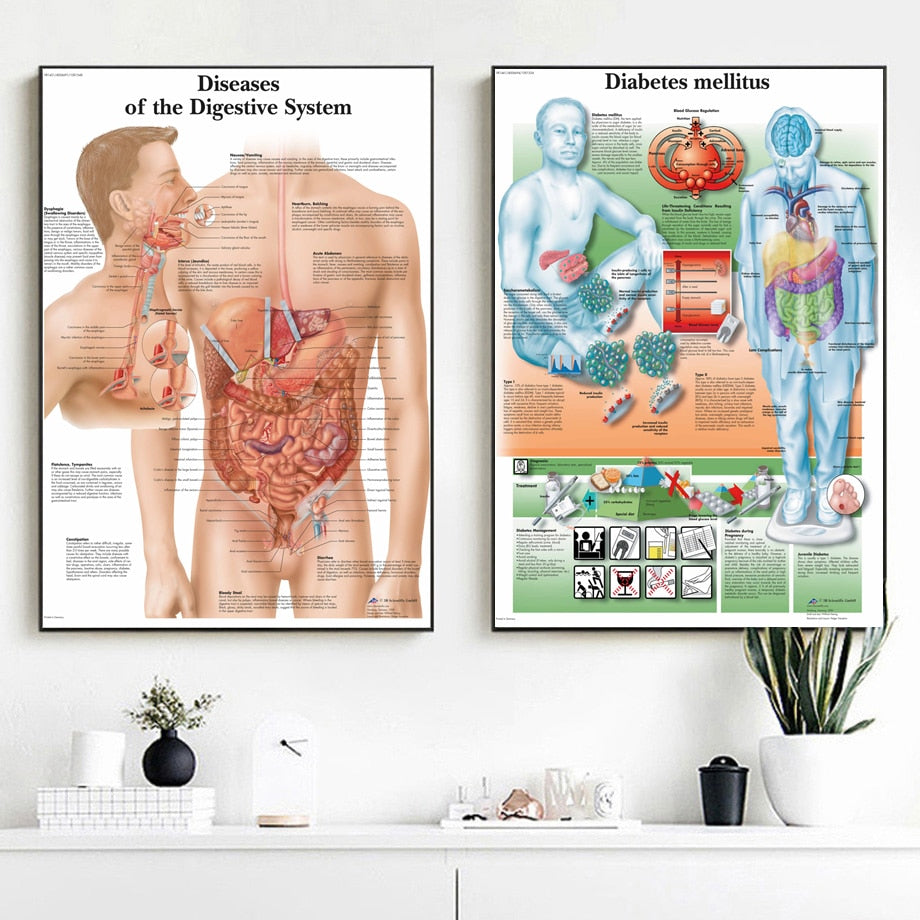 Póster de anatomía - patologías humanas