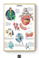 Póster Anatomía y enfermedades humanas