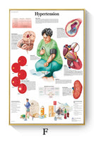 Póster de patologías humanas