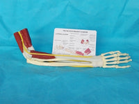 Modelo de función de ligamento articular