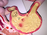 Modelo anatómico colorectal