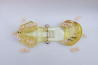 Modelo de implantes dentales