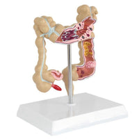 Modelo Anatomico de colon
