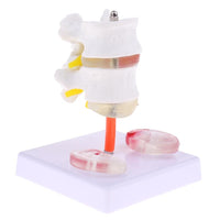 Vértebra Lumbar humana de 2 discos