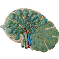 Modelo de agrandamiento de nódulos linfáticos humanos