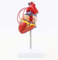 Modelo de corazón humano con arteria coronaria Bypass de tamaño real puente miocardico