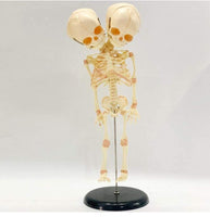 Modelo de esqueleto bebé doble cabeza Doble cabeza