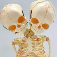 Modelo de esqueleto bebé doble cabeza Doble cabeza