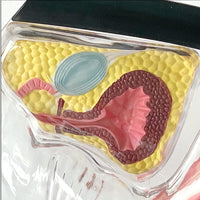 Anatomia de utero transparente - modelos anatomicos ginecologia