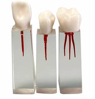 Modelo dental de restauracion bloqueo endodoncia 6 piezas