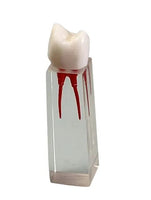 Modelo dental de restauracion bloqueo endodoncia 6 piezas