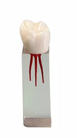 Modelo dental de restauracion bloqueo endodoncia 6 piezas