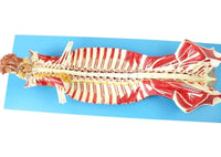 Modelo anatomico de espina dorsal humana anestesia columna vertebral nervio espinal