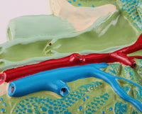 Modelo de agrandamiento de nódulos linfáticos humanos