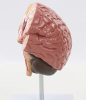 Modelo Cerebral Senil con patología