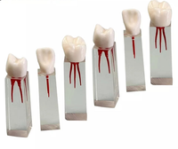 Modelo dental de restauracion bloqueo endodoncia 6 piezas