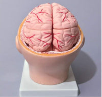 Cabeza con Cerebro Arteria cerebral