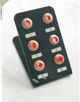 Modelo anatomico de cervix - lesion cervical