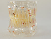 Modelo dental patologico completo