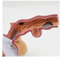 Modelo anatomico de esofago de Barrett patologias